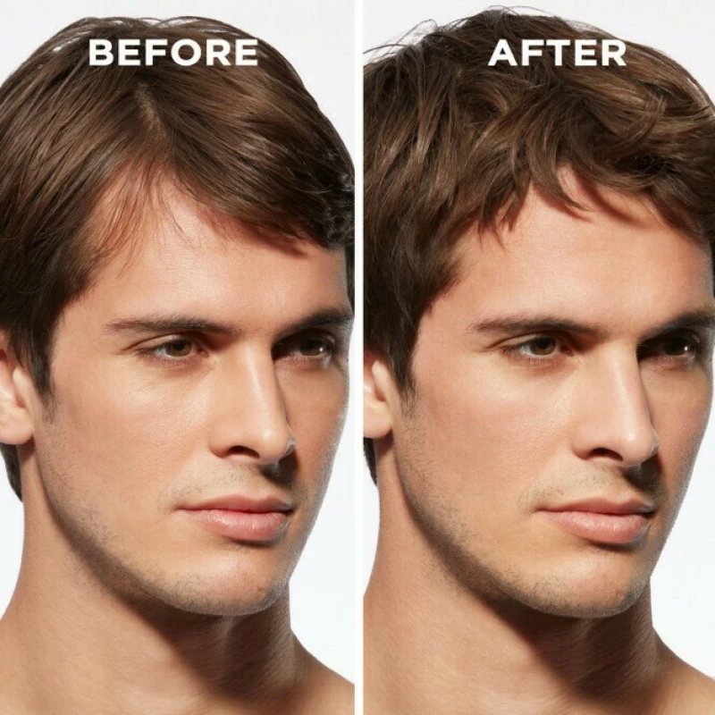 Kérastase Genesis Homme Anti-Chute Fortifiant Homme Serum κατά της Τριχόπτωσης για Όλους τους Τύπους Μαλλιών 90ml